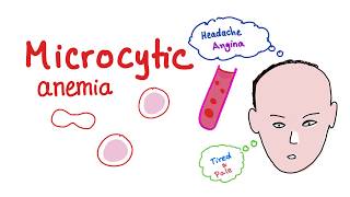 Microcytic Anemia introduction [upl. by Egwan]