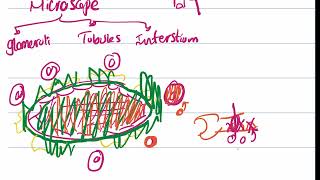 pathology of renal vascular system Hypertension 3 [upl. by Philender121]