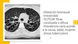 Bronquiectasias [upl. by Berti]