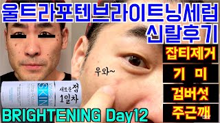 어드마이어마이스킨 DAY12 피부가 진해졌다구요 걱정마세요  울트라포텐브라이트닝세럼  Admire my skin ultra potent brightening serum [upl. by Fletch]