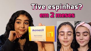 Testei por 2 meses SABONETE ACNEZIL pele oleosa [upl. by Katy]