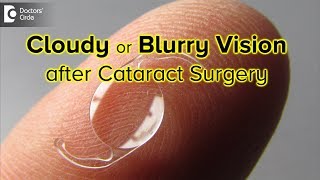 How long is your vision blurry or cloudy after cataract surgery  Dr Sriram Ramalingam [upl. by Cirdes]