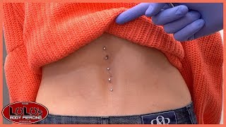 5 Back Dermal Piercings In 1 Day [upl. by Kwan867]