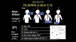 淋巴癌上課 20245月版對住院醫師、學生及專師的上課專業版  含歷屆醫師國考題amp內專考題 [upl. by Man741]