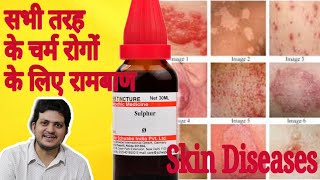 Sulphur Mother Tincture ko kaun kaun si skin disease चर्म रोग में use Karen aur kaise use Karen [upl. by Annhoj964]