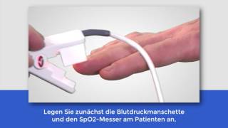 Connex® Spot Monitor CSM Training Video deutsche Untertitel [upl. by Ivets]