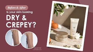 Rejuvenate Dry and Crepey Skin with Crepe Erase® [upl. by Eseilanna343]