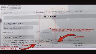 HIV Positive for 25 Years then HIV is GONE  PCR Test Result [upl. by Aleafar247]