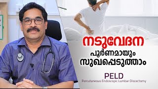 നടുവേദന മാറാൻ ഏറ്റവും എളുപ്പ മാർഗം  Back Pain Treatment in Malayalam Health Tips [upl. by Shandeigh]