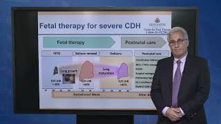 Postnatal Care and Survival—Fetoscopic Tracheal Occlusion for Severe Congenital Diaphragmatic Hernia [upl. by Cristie780]