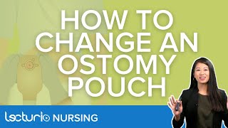 How To Change An Ostomy Pouch  Explanation amp Demonstration  Lecturio Nursing [upl. by Nahtanhoj]