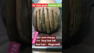 Leech therapy for hair problems [upl. by Anoit]