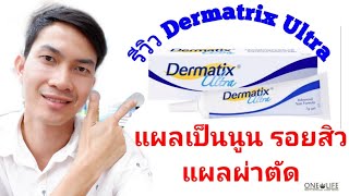 🌱🌿รีวิวการใช้ Dermatrix Ultra กับแผลเป็นนูน รอยสิว แผลผ่าตัด 🌿เภ💊สายเฮลท์🌾 [upl. by Leahcimrej]