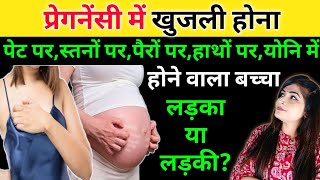 प्रेगनेंसी में खुजली l Itching During Pregnancy l Symptoms Of Baby Boy Or Girl [upl. by Suilenrac]