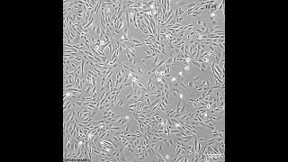 How quick do these melanoma cells grow [upl. by Guyon78]