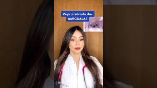 AMIGDALECTOMIA COMO É A CIRURGIA DE RETIRADA DAS AMÍDALAS [upl. by Yerfoeg]