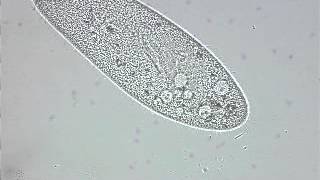 paramecium contractile vacuole [upl. by Otecina949]