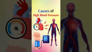 Causes of High Blood Pressure shorts [upl. by Aihsile324]