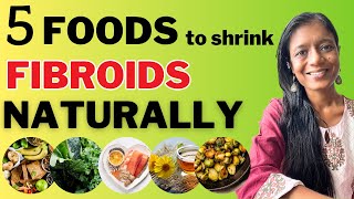 Fibroids Diet 5 Foods to Shrink Fibroids Naturally [upl. by Fabiolas]