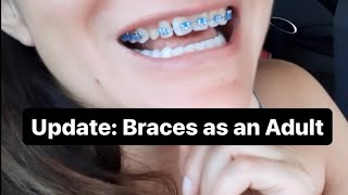 BRACES JOURNEY part two Adult Braces week ONE and week SIX My experience so far [upl. by Delia]