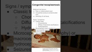 Congenital toxoplasmosis [upl. by Airogerg]