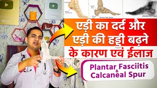 ऐड़ी के दर्द और ऐड़ी की हड्डी बड़ने का घरेलू ईलाज । Plantar Fasciitis amp HeelCalcaneal Spur viral [upl. by Leisam636]