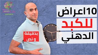 أعراض الكبد الدهني بدقيقة و نص 07 [upl. by Areic627]