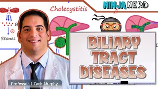 Biliary Tract Diseases  Clinical Medicine [upl. by Sturges964]