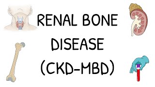 Renal Bone Disease CKDMBD  Explained simply and clearly [upl. by Atazroglam523]