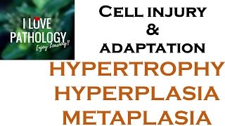 Cell Adaptations pathologyHYPERTROPHY HYPERPLASIA AND METAPLASIA [upl. by Rao]