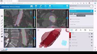 Tutorial How to Review a Case in Mimics Viewer [upl. by Adaha]