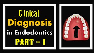 Diagnosis in ENDODONTICS  Part 1 [upl. by Ahtikal]