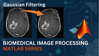 Gaussian Filter  MATLAB Code Implementation  Medical Image Processing  Computer Vision [upl. by Minne]