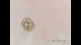 Embryonated Toxocara egg │wwwuplbparaslabwebscom [upl. by Retsbew]