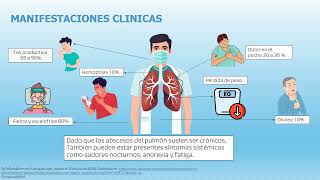 ABSCESO PULMONAR [upl. by Aetnuahs]