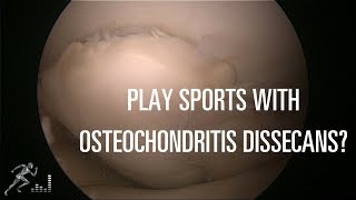 Should you play sports with an OCD lesion in your knee [upl. by Tudela]