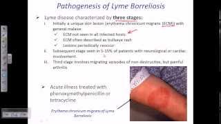 Lyme disease by borrelia [upl. by Lennahs908]