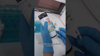 Urinanalysis part 1 Physical Examination of urine in 5 minutes [upl. by Aramot636]