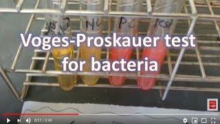 V PVogesProskauer Test for bacteria [upl. by Bambie87]