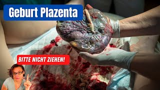 Geburt der Plazenta  warum das Ziehen an der Nabelnschnur vermieden werden sollte [upl. by Attelrac]