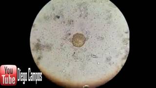 Ascaris lumbricoides Huevo larvado Coproparasitologia [upl. by Gnolb]