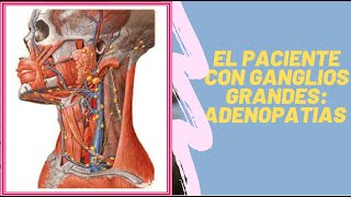 EL PACIENTE CON GANGLIO GRANDES ADENOPATIAS [upl. by Easton793]