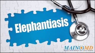 Elephantiasis ¦ Treatment and Symptoms [upl. by Noe]