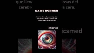 Triada de Horner enarm viral viralvideos video medicina doctor quiz fyp parati si [upl. by Krock]