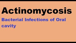 Actinomycosis  Bacterial infections of the oral cavity [upl. by Ailahk]