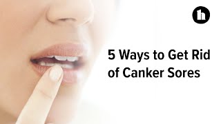 5 Ways to Get Rid of Canker Sores  Healthline [upl. by Sad964]