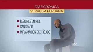 🔴 TEMOR ECUADOR REGISTRA POSIBLE PRIMER CASO DE VERRUGAPERUANA O FIEBRE DE OROYA cortesia Ecuavisa [upl. by Clementina]