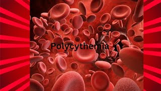 Polycythemia definition  Polycythemia rubra veratypes causes Sings and symptoms [upl. by Conte951]