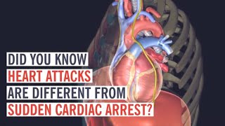 Heart Attack vs Cardiac Arrest What’s the Difference [upl. by Nohtahoj439]