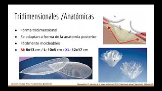 Pared abdominal Hernias parte 1 Dr Alan Fernández [upl. by Markiv]